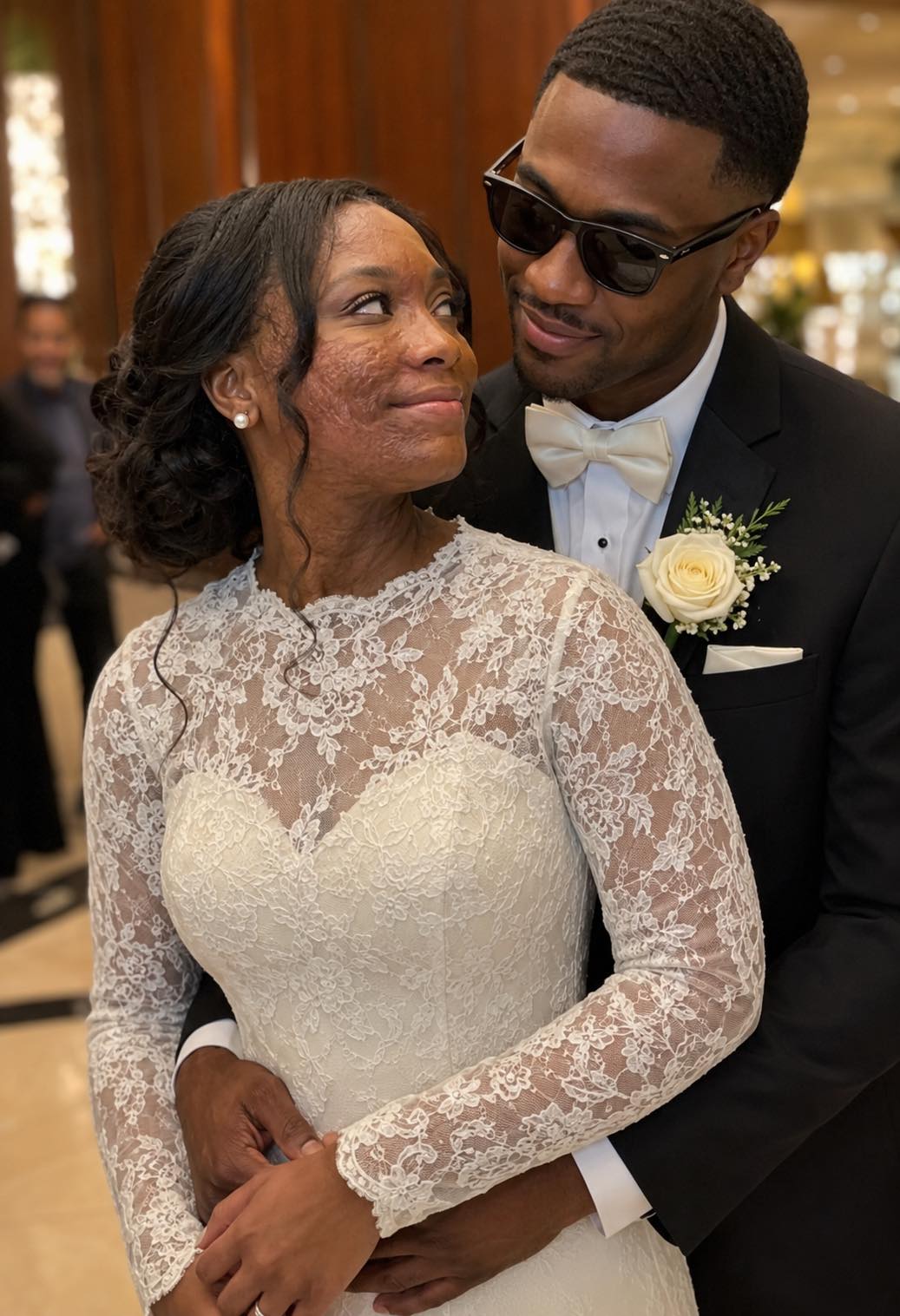 I Married a Blind Man So He’d Never See My Scars – On Our Wedding Night, He Said, ‘You Need to Know the Truth I’ve Been Hiding for 20 Years’